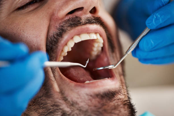 Best Emergency Treatment for Toothache in Camas, WA